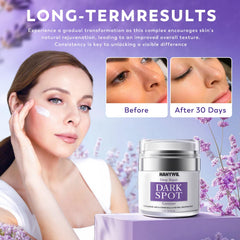 HANYWIL dark spot remover body cream jar targets discoloration for smoother skin.