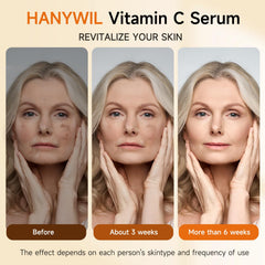 HANYWIL serum with hyaluronic acid illustration for lasting moisture.