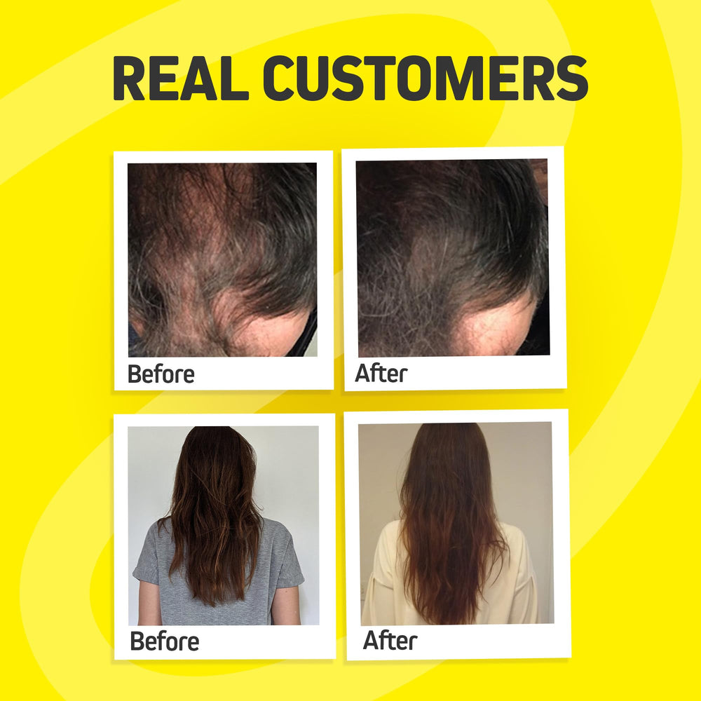 Herbtonics Hair Growth Vitamins label details showcase DHT blocker and botanicals.