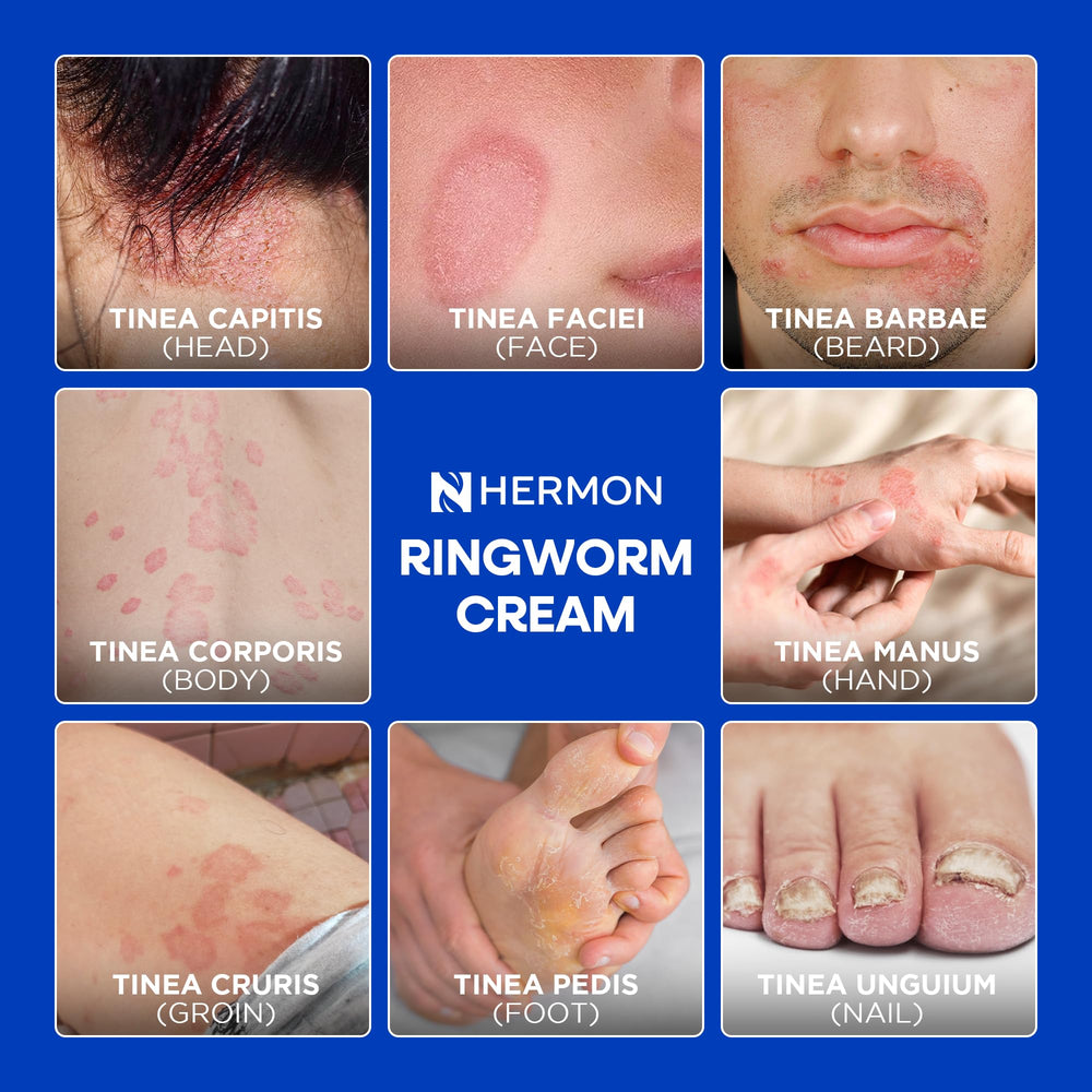 Hermon antifungal cleansing soap applied to feet exposes athlete's foot care use.