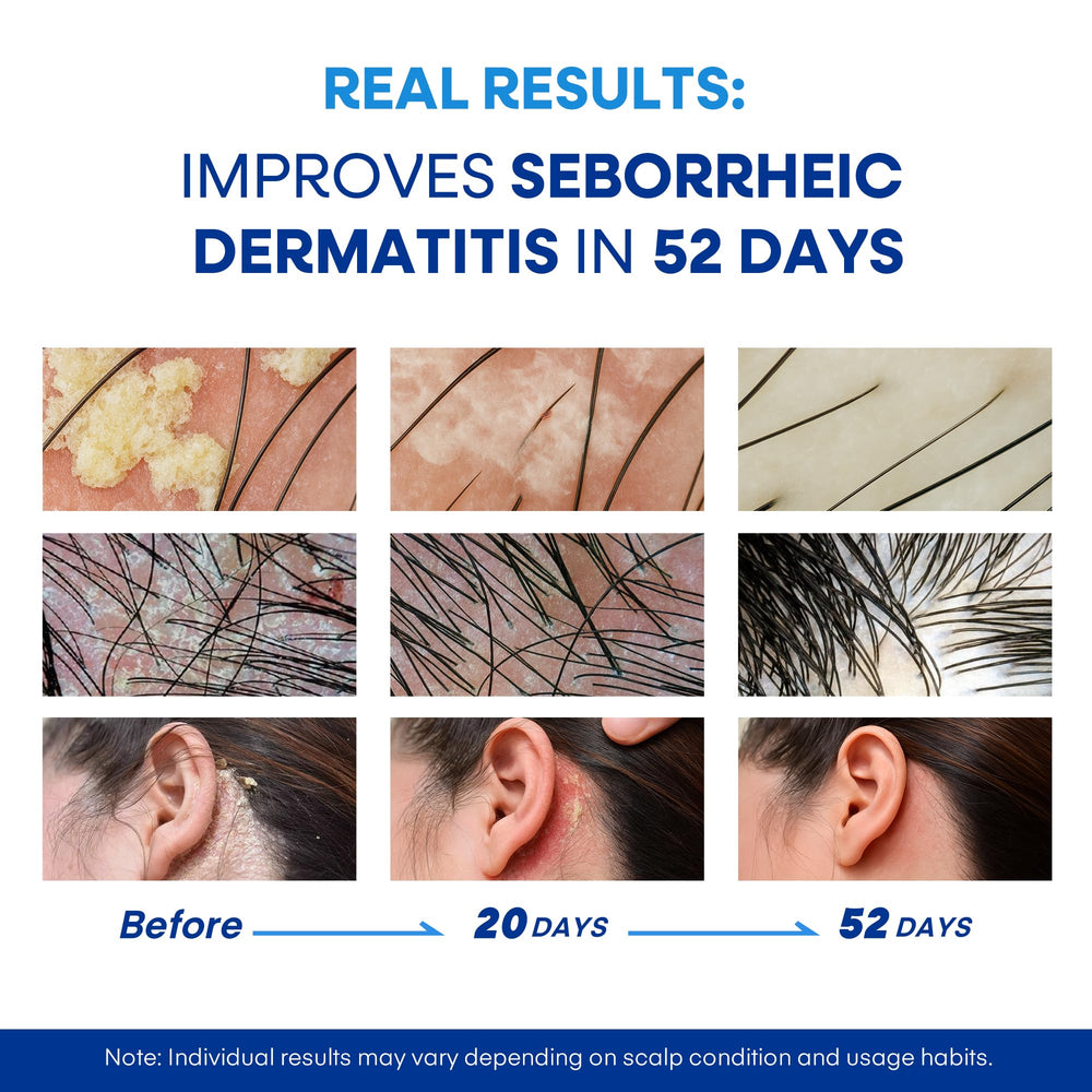 Hermon formula features soothing botanical extracts for calm, balanced scalp.
