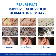 Hermon formula features soothing botanical extracts for calm, balanced scalp.