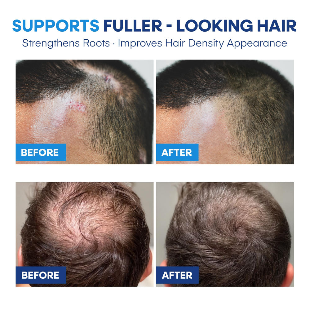 Hermon supports healthy hair follicles for fuller-looking strands.