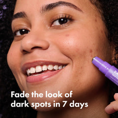 Hero Cosmetics Dark Spot Correct rollerball tip enables precise, on-the-go application.