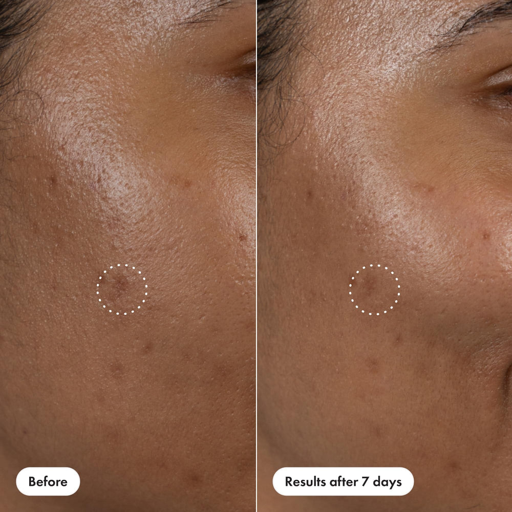 Hero Cosmetics non-comedogenic formula supports acne-prone skin care.