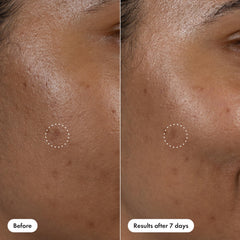 Hero Cosmetics non-comedogenic formula supports acne-prone skin care.
