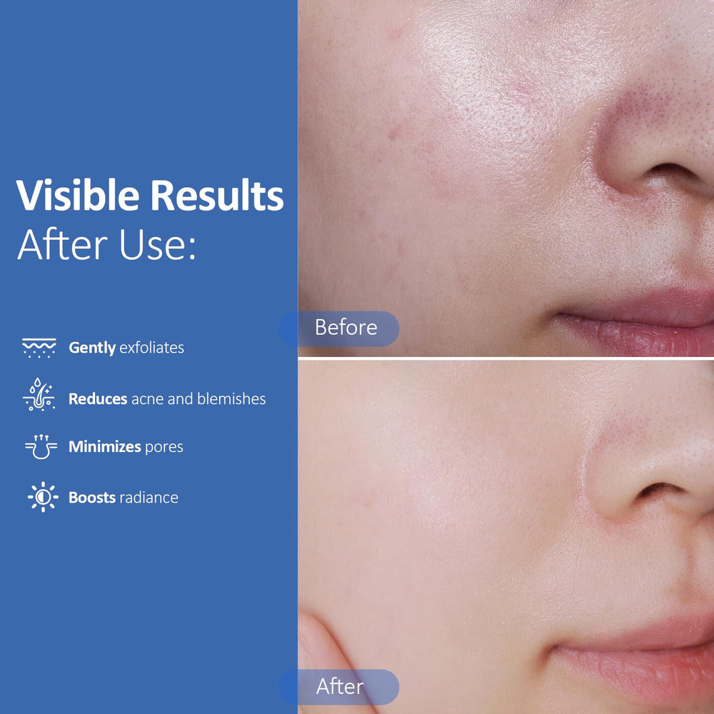 Hicream exfoliating pads dual-textured surface close-up