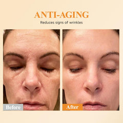 HKH Dermatologist tested fragrance free formula suitable for sensitive skin.