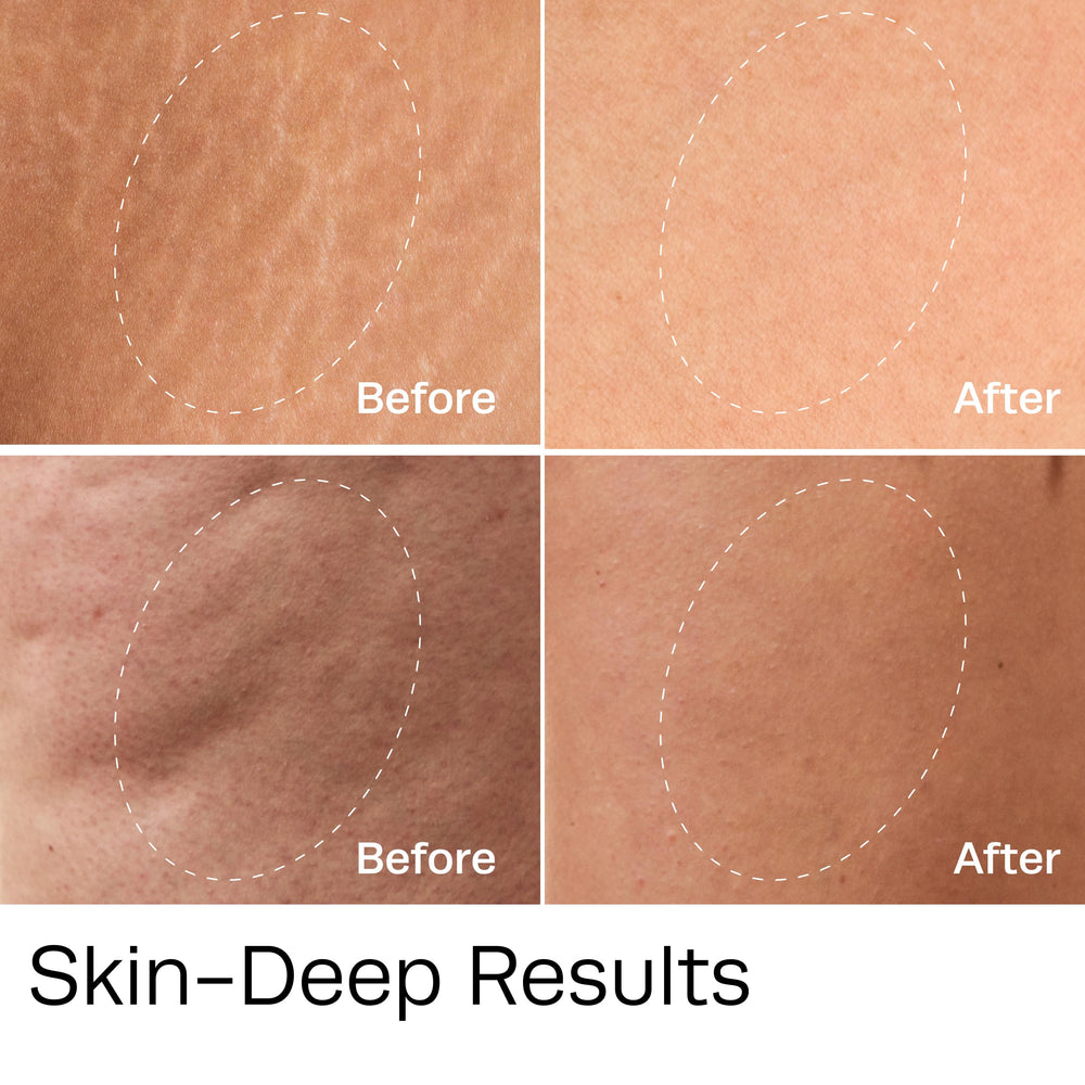 Hot Vita Vitamin C Body Oil on legs showing hydrated, smooth skin.