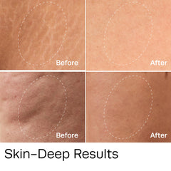 Hot Vita Vitamin C Body Oil on legs showing hydrated, smooth skin.