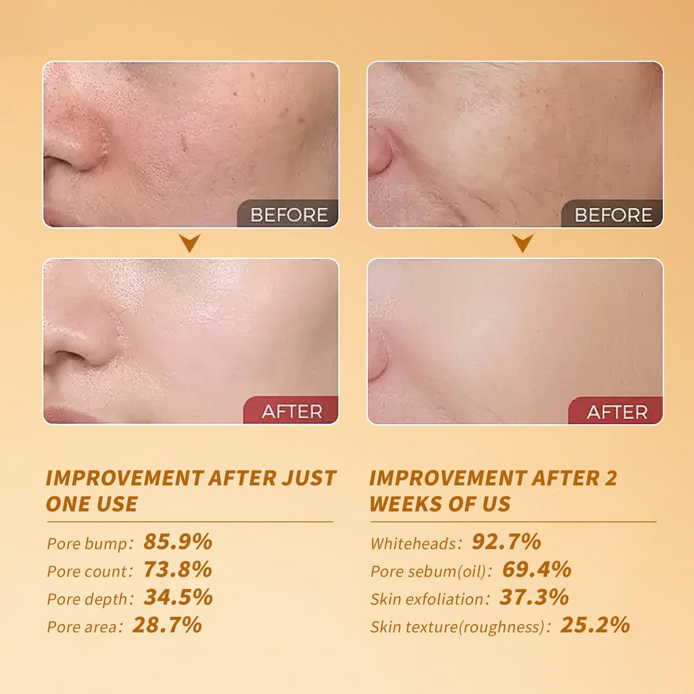 HUiPENGFEI layering-friendly exfoliant ampoule for seamless makeup and actives use.