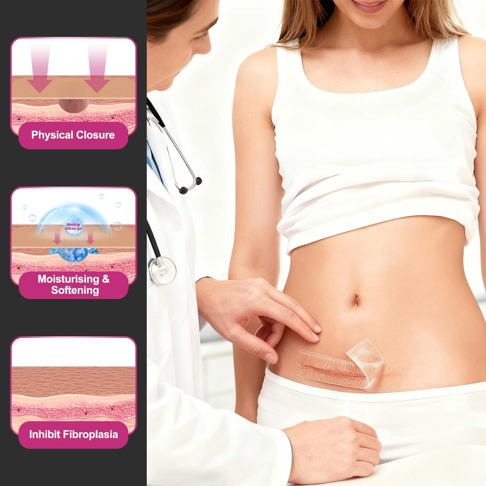 Hysimedy soft release liner enables easy application on the scar area