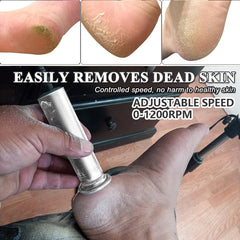 I·B·N G upgrade includes 60 replaceable discs for long-lasting pedicure sessions.