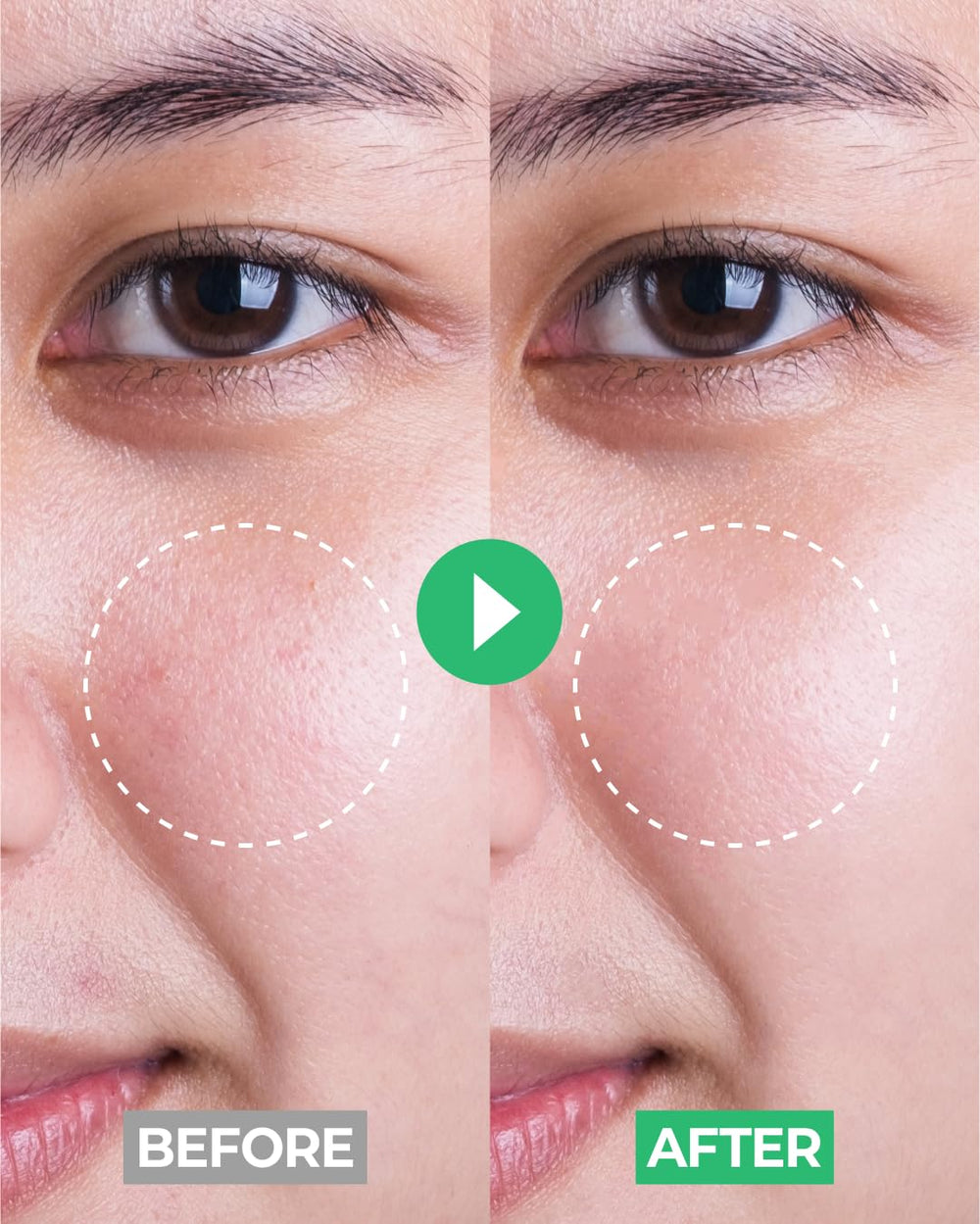iBodle gentle cleanser for delicate young skin.