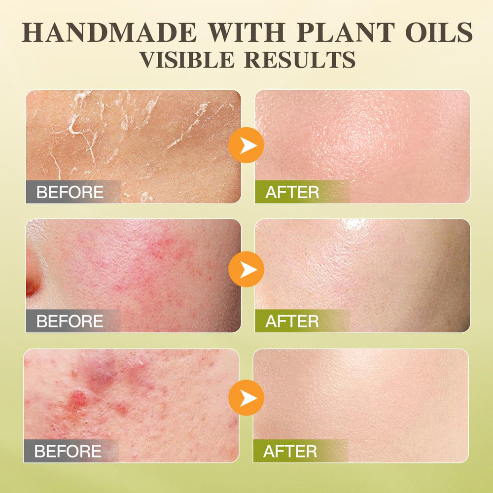 ICIKOL balm ready for full body care and daily moisturization
