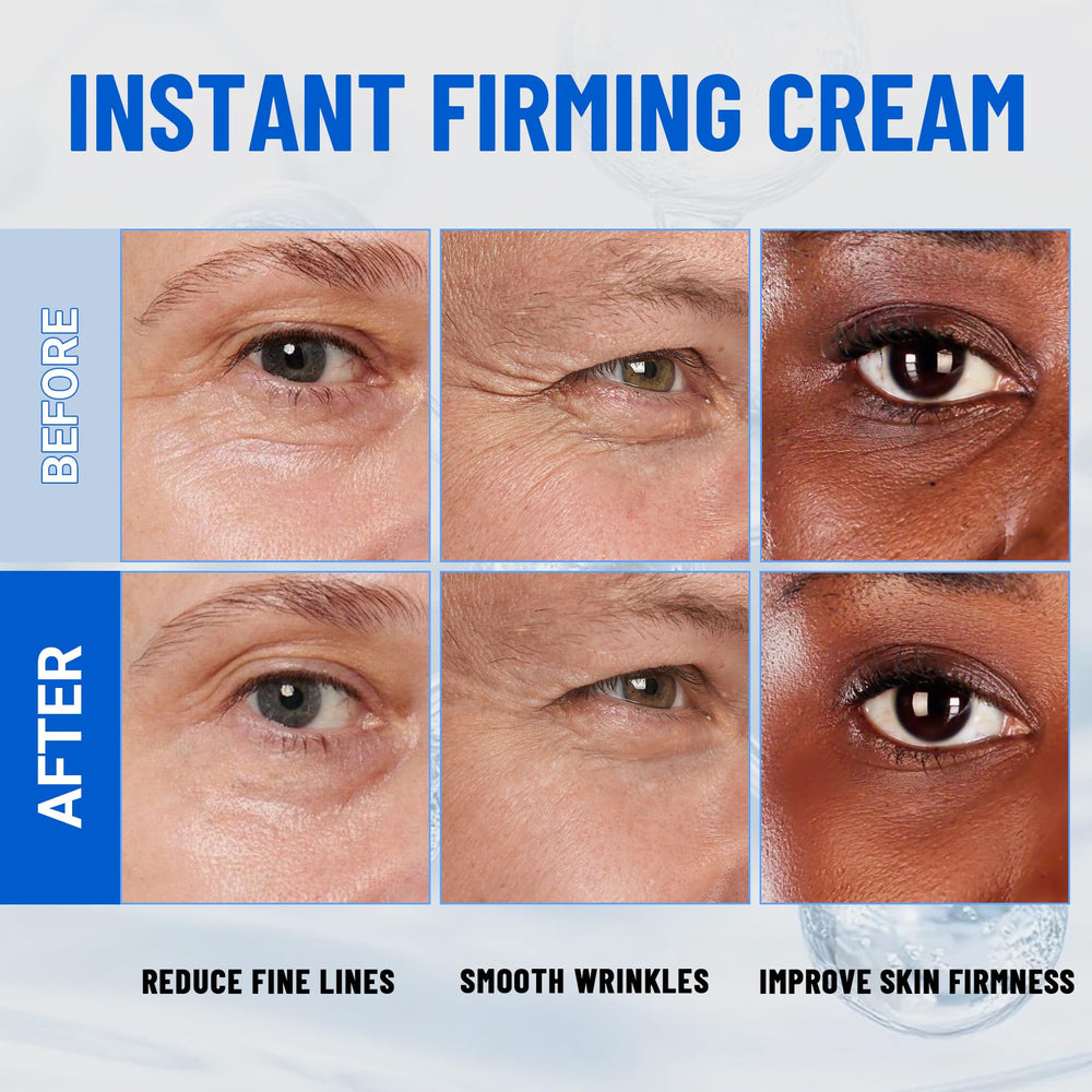 iMethod Perfection Eye Tightener in-use on dry skin reducing dryness lines