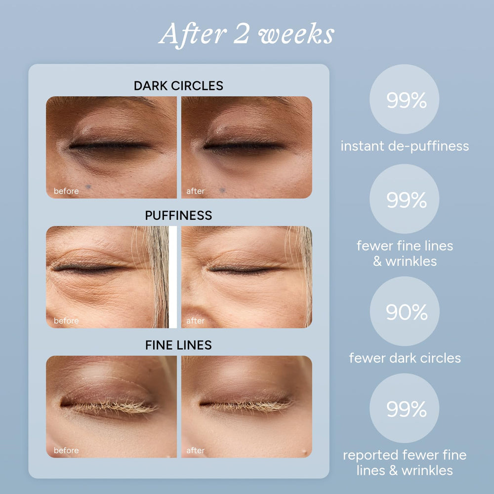 In My Eyes upper-lids focus patches reduce puffiness for a more awake appearance.