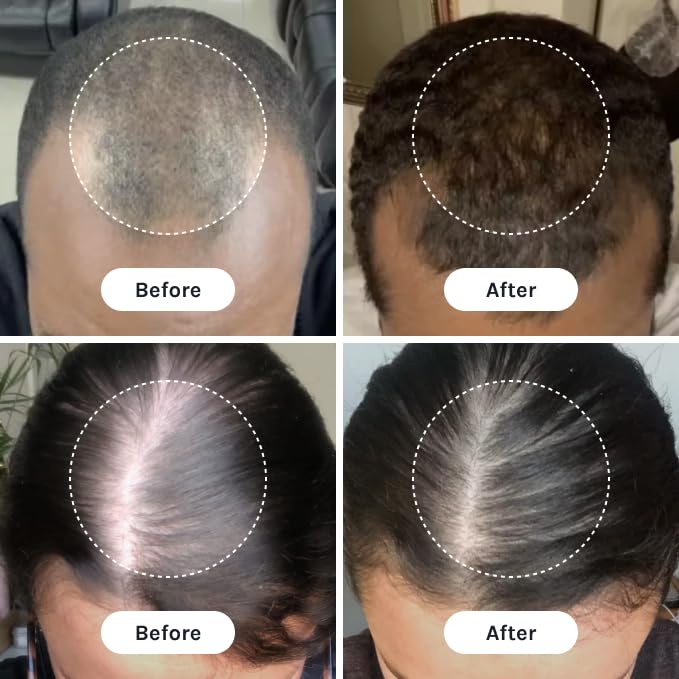 InfiniWell scalp application imagery showing gentle serum massage for renewal.
