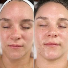 Intraceuticals Rejuvenate Daily Serum creates makeup-ready, hydrated skin.