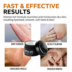 IOIOTCO Urea Cream on feet and heels for smoother skin.