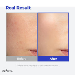 IsNtree Aqua Gel Cream fragrance-free formula keeps skin calm after use.