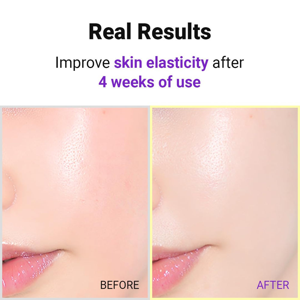 IsNtree Hyper Retinol EX yellow tint indicates lightweight, fast-absorbing formula.