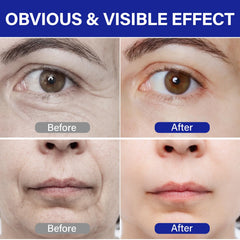 ITE CFREELY peptide complex vial emphasizes 50 peptide blend for plumpness