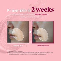 it:fu Blending Collagen UpTox Ampoule close-up skin elasticity potential improvement