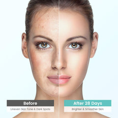 Jacrynth dark spot remover on face targets uneven tone precisely