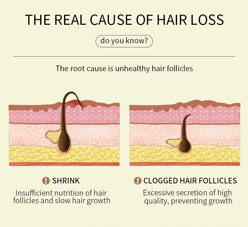 JISKG EELHOE applying oil to scalp during routine