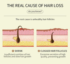 JISKG EELHOE applying oil to scalp during routine