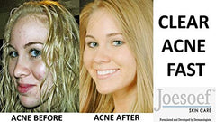JOESOEF SKIN CARE sulfur-based bar suitable for oily to normal skin routines.