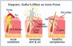 Micronized sulfur detail on JOESOEF soap showing natural volcanic origin and cleansing support