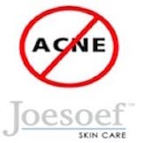 Rosacea-friendly routine with JOESOEF sulfur soap in calm bathroom setting