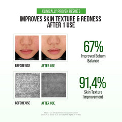 JUMISO D-Panthenol Barrier Serum dermatologist tested and gentle on sensitive skin.