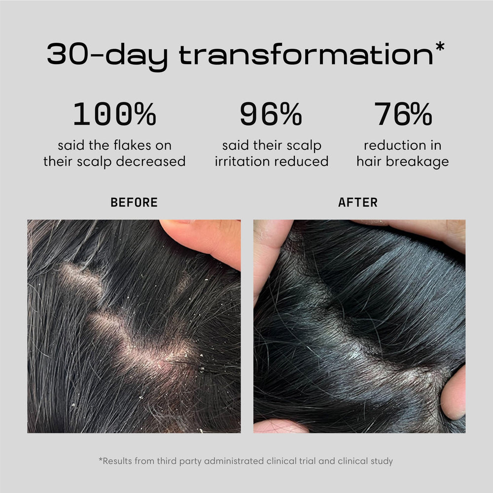 Jupiter anti-dandruff shampoo lather showing gentle cleansing for itchy scalps.