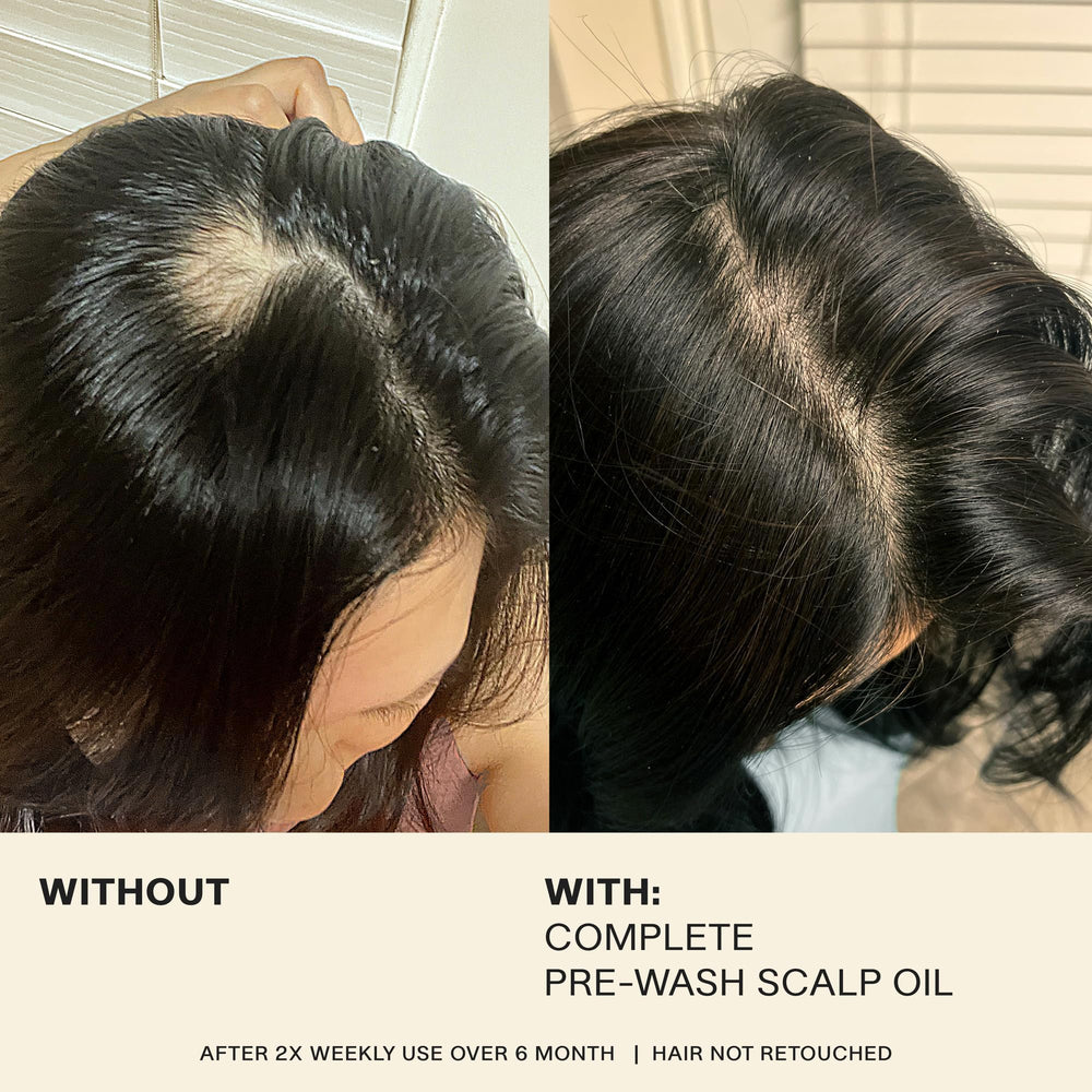 JVN pre-wash-scalp-oil-before-after suggests potential look and feel improvements after treatment.