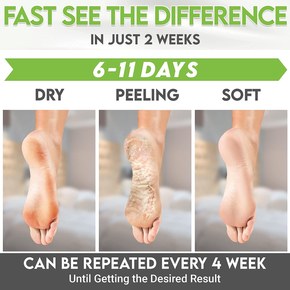 Karma Organic Foot Peel Mask five-step usage guide illustration.