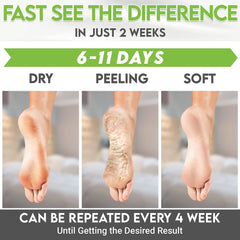 Karma Organic Foot Peel Mask five-step usage guide illustration.