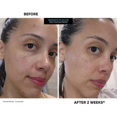 Kate Somerville EradiKate packaging image hints at consistent daily use.