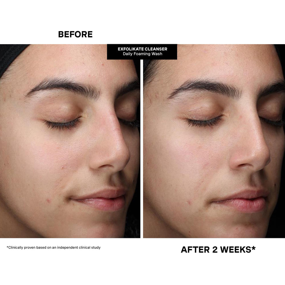 Kate Somerville ExfolKate texture-smoothing action close-up