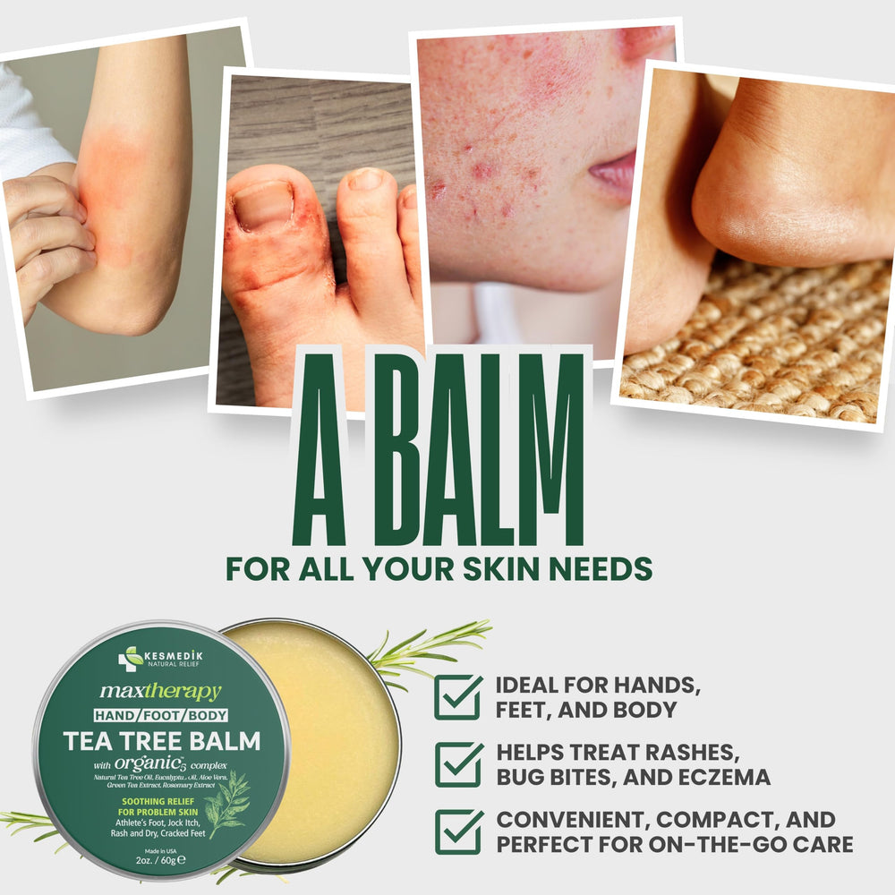 KESMEDIK Tea Tree Oil Balm on skin delivering soothing relief from itching