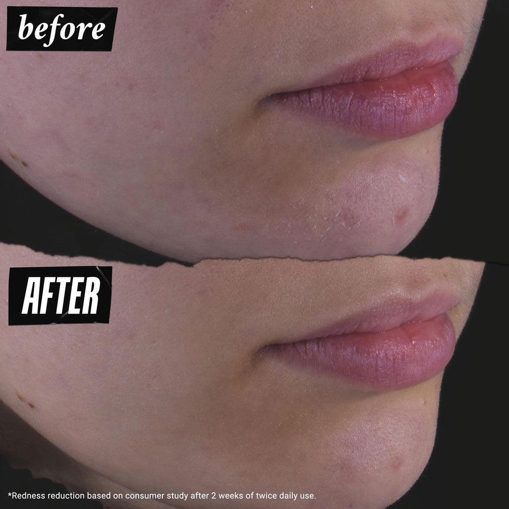 Kiehl's Calendula toner being swept across the face during routine.