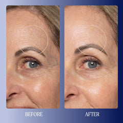 Kinship triple ceramide complex closeup points to barrier-repair benefits.