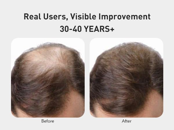 Close-up of KINTOR KX-826 spray applied to scalp for absorption