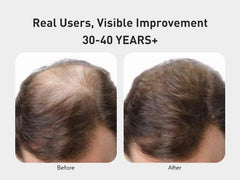 Close-up of KINTOR KX-826 spray applied to scalp for absorption