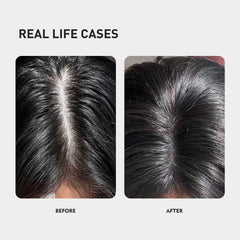 KINTOR 0.5% KX-826 spray action demonstrates easy scalp targeting and application