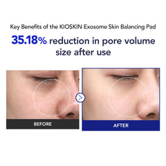 Kioskkin Brightening glow appears after routine to enhance radiance.