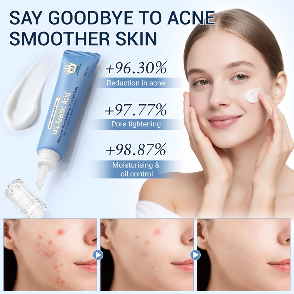 KIUORET cream offers oil control while keeping skin balanced.