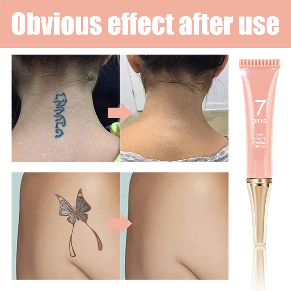 KlsyChry product packaging displayed as an at-home tattoo removal option.